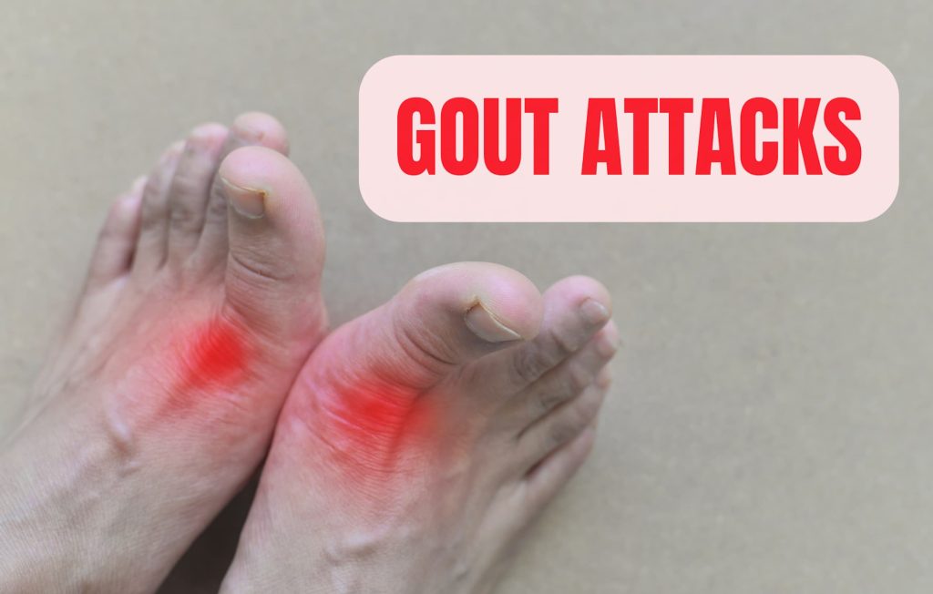 Gout Attacks